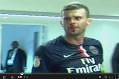 موتا يتعرض لاعتداء دموي من لاعب باستيا