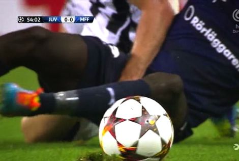 كوناتي: لاعب يوفنتوس اعتدى عليّ  و"قتل" رجولتي
