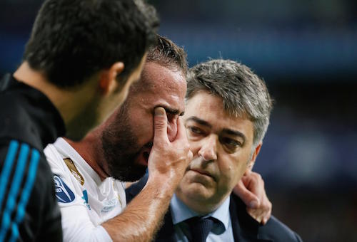 إصابة كارفاخال تثير القلق في ريال مدريد