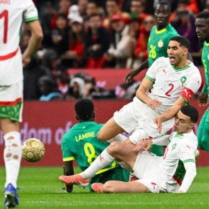 "الاحتقان" يلغي ندوة مدرب السنغال